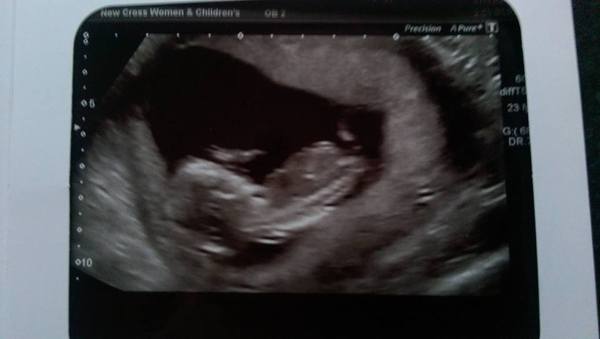 May 2016 - May the sickness end soon!