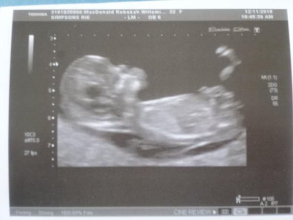 May 2016 - May the sickness end soon!