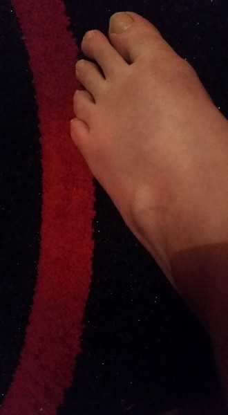 What have I done to my foot- very painful (picture)