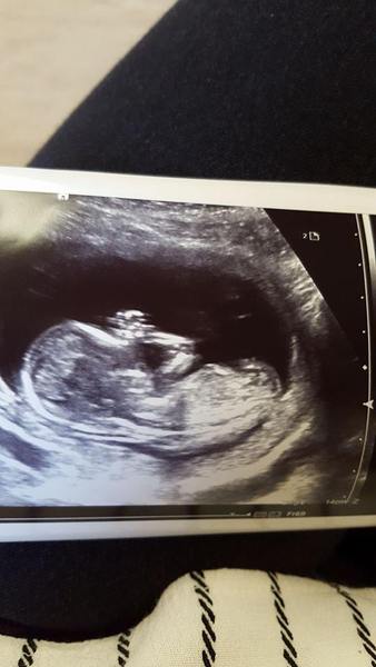 Any ideas on the sex of this baby please?