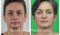 Facial Detox Massage/Exercises - Master Tiong
