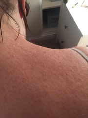 April 2016 babies. Nausea, bloating and wind - feeling HOT!