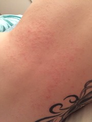 April 2016 babies. Nausea, bloating and wind - feeling HOT!