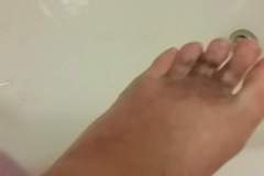 What have I done to my foot- very painful (picture)