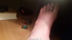 What have I done to my foot- very painful (picture)