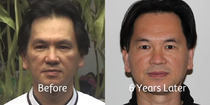 Facial Detox Massage/Exercises - Master Tiong