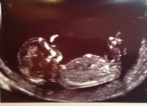 Any guesses re: gender??