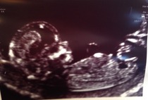 Any guesses re: gender??