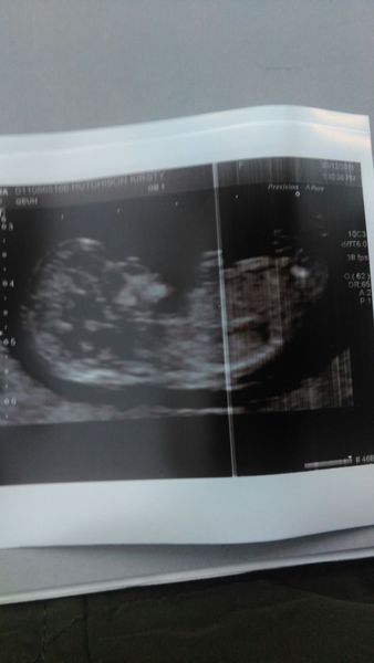 Anyone want to guess the gender ? Xx