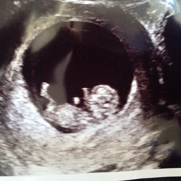 Anyone ttc baby #2?