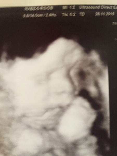 Feb 2016 babies: Welcome to the 3rd trimester - the final stretch! (in more ways than one)