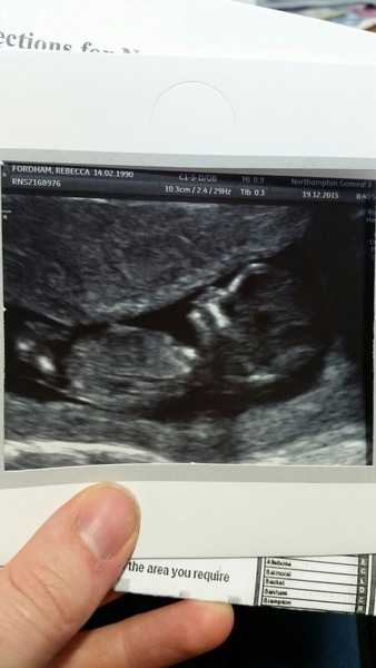 June 2016 thread #5 Starting the great gender speculation. ..