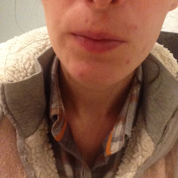Clinique anti blemish foundation