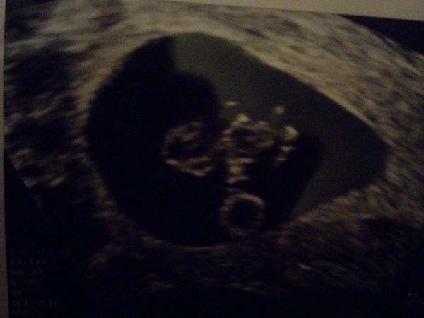 August 2016-with Berries turning into Beans and a whole lotta fun ahead!