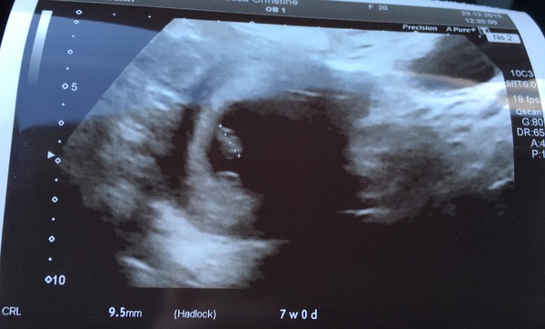 August 2016-with Berries turning into Beans and a whole lotta fun ahead!