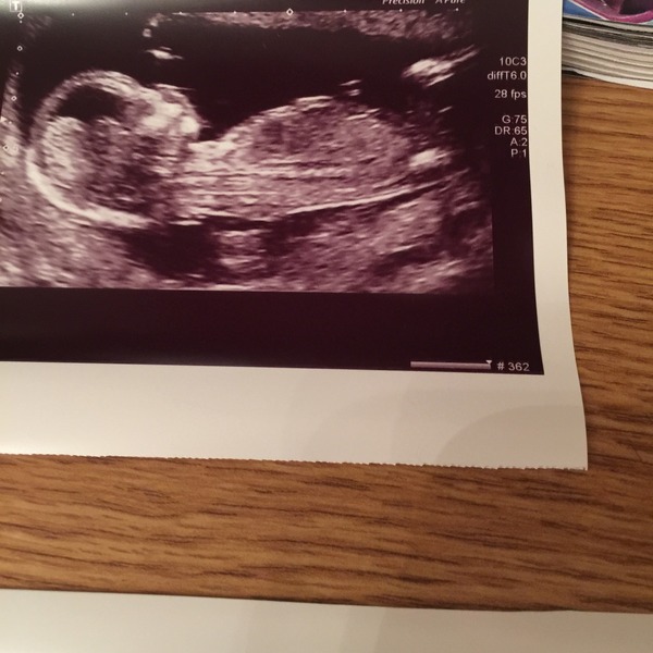 June 2016 thread #5 Starting the great gender speculation. ..