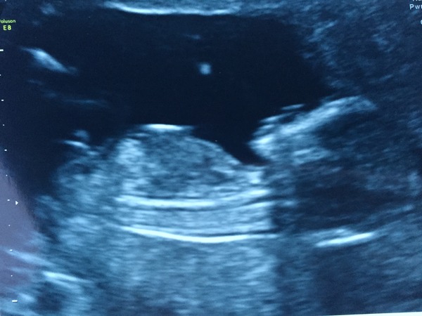 June 2016 thread #5 Starting the great gender speculation. ..