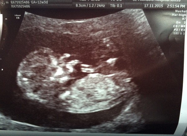 Anyone want to guess the gender ? Xx