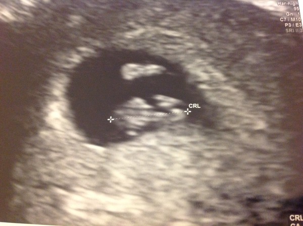 August 2016-with Berries turning into Beans and a whole lotta fun ahead!