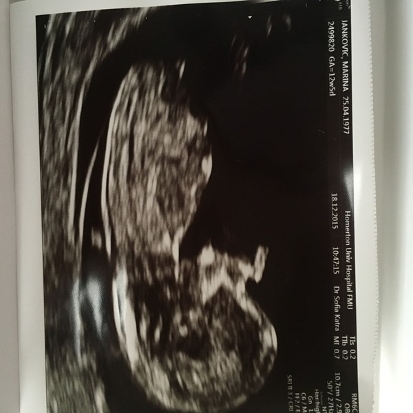 June 2016 thread #5 Starting the great gender speculation. ..