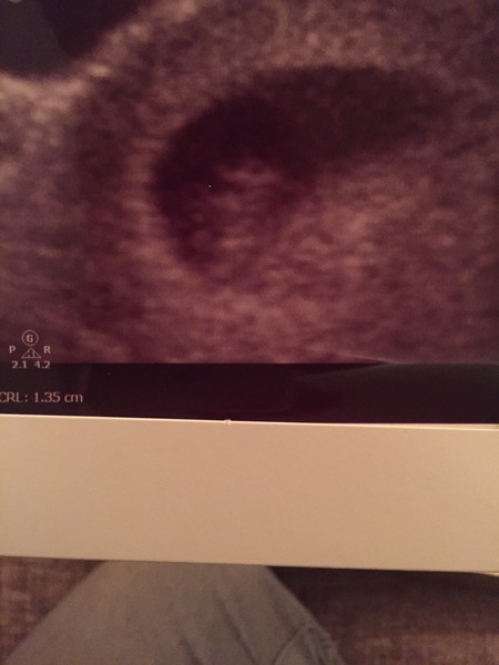 We're multitasking by crocheting and blood testing our way through pregnancy. We are waiting for our clutch of Christmas babies to hatch while our newbies are gearing up for scans, it's JS Grads 42!