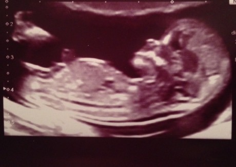 June 2016 thread #5 Starting the great gender speculation. ..