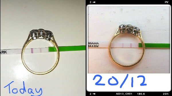 Ttc#1 Thread the 4th. TMI club of January 2016. No symptom too disgusting to share!