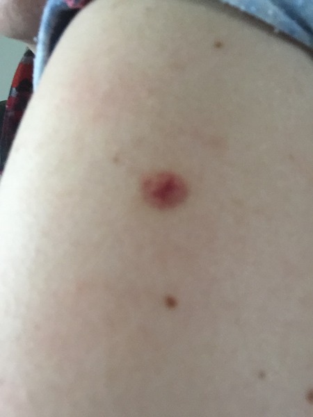Moles