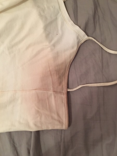 Brown marks on white vest? *pic*