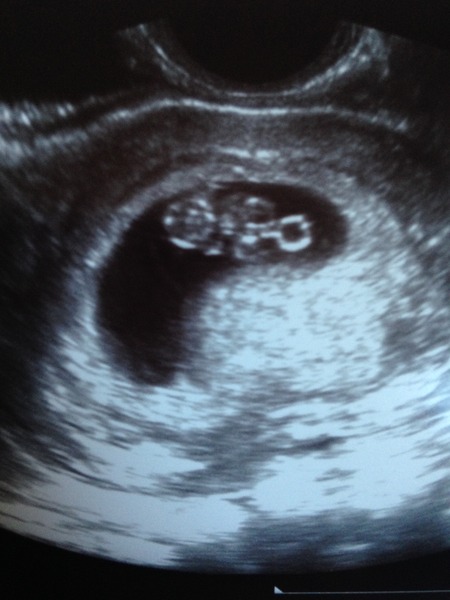 August 2016-with Berries turning into Beans and a whole lotta fun ahead!