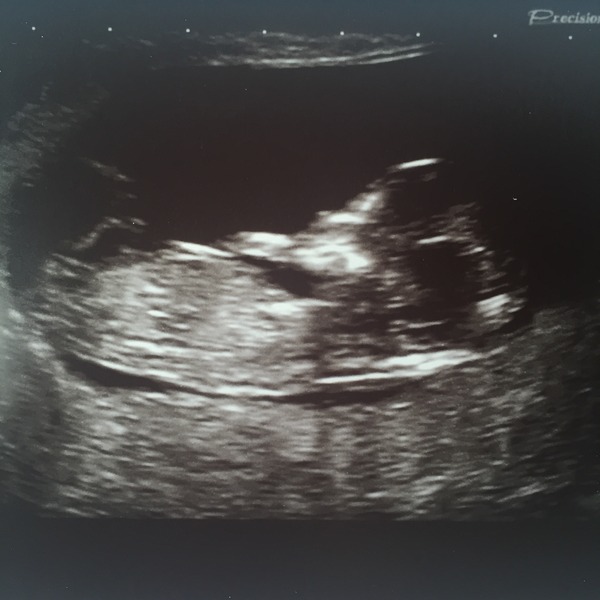 Update from my scan 😊