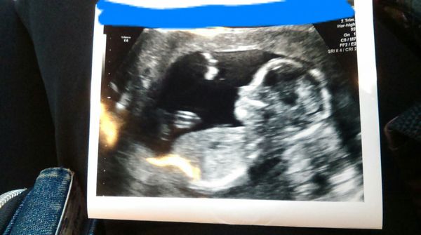 June 2016 thread #5 Starting the great gender speculation. ..