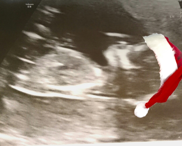 June 2016 thread #5 Starting the great gender speculation. ..