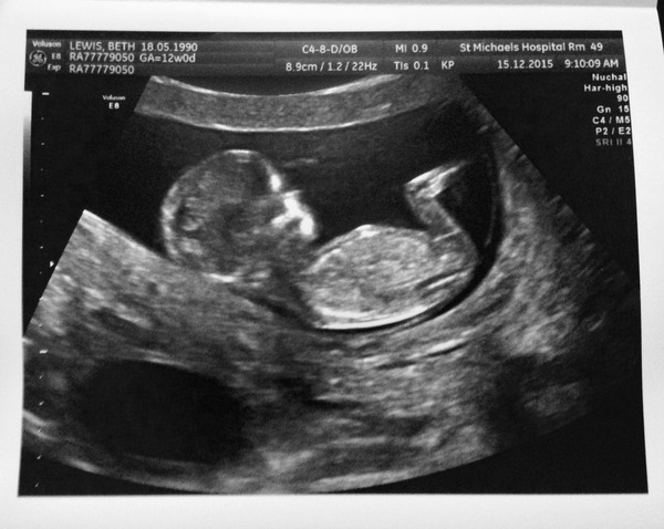 June 2016 thread #5 Starting the great gender speculation. ..