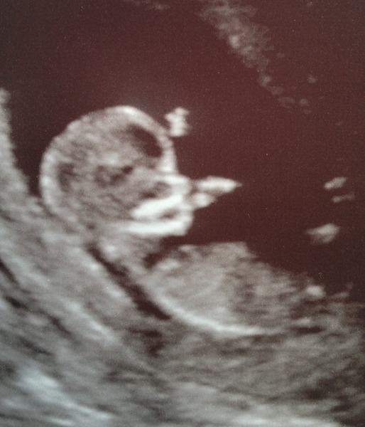 June 2016 #4 - 12 week scans, seeing tiny feet and hands!