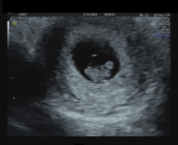 August 2016-with Berries turning into Beans and a whole lotta fun ahead!