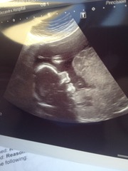 Celebrating Christmas with the arrival of BabyBloom and XmasPud - we're testing our pelvic floors through the festive season, mince pie tasting and turkey stuffing (nudge nudge), it's the JS Grads 43!