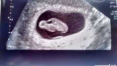 We're multitasking by crocheting and blood testing our way through pregnancy. We are waiting for our clutch of Christmas babies to hatch while our newbies are gearing up for scans, it's JS Grads 42!