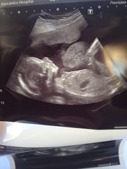 Celebrating Christmas with the arrival of BabyBloom and XmasPud - we're testing our pelvic floors through the festive season, mince pie tasting and turkey stuffing (nudge nudge), it's the JS Grads 43!