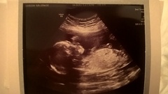 May 2016 - May the sickness end soon!