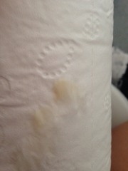 Would you say this is blood tinged? [Warning, pics included]