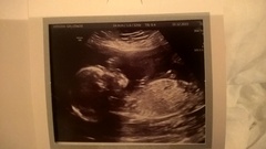 May 2016 - May the sickness end soon!