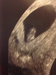 August 2016-with Berries turning into Beans and a whole lotta fun ahead!