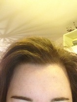Sick of hormonal teenage skin :(