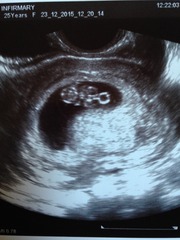 August 2016-with Berries turning into Beans and a whole lotta fun ahead!