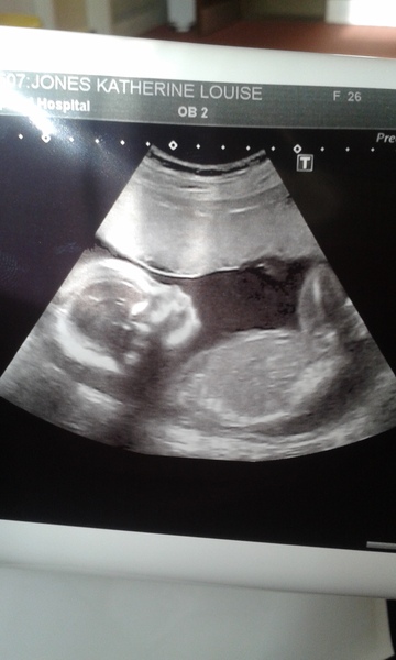 March 2016 Babies!! Thread #7 The one where we all say.... "Stay put Flump!!"