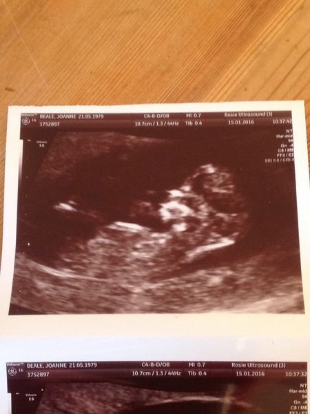 August 2016-with Berries turning into Beans and a whole lotta fun ahead!