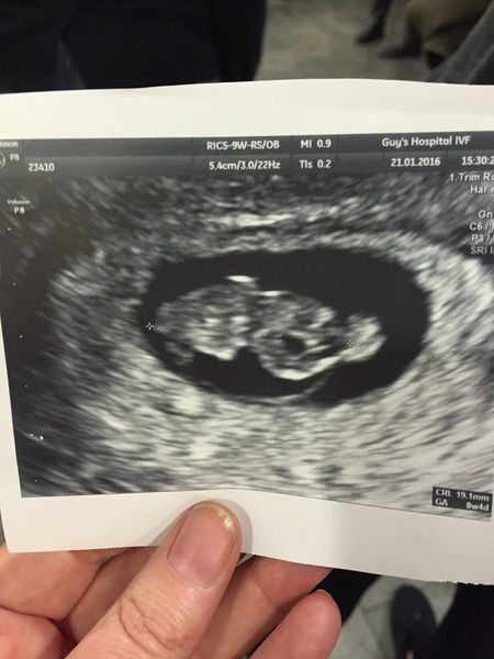 Forty and over trying for a first baby - join us here
