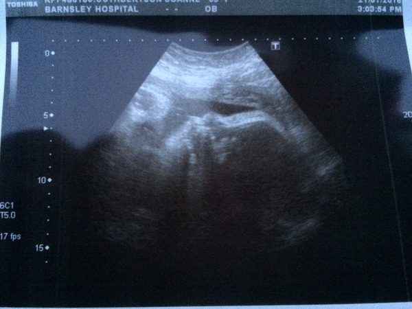 Feb 2016 Babies: The One Where the Babies Start Arriving!