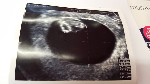 Had a reassurance scan today and just had to share...